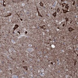 WIPF3 Antibody, Novus Biologicals 0.1mL; Unlabeled:Antibodies, Polyclonal